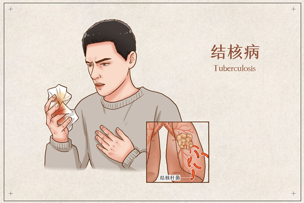 肺結核咳血